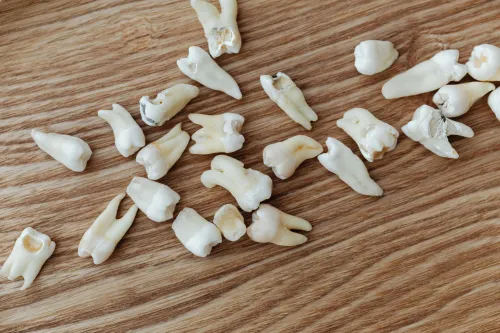 Root Canal Therapy at Hometown Dental