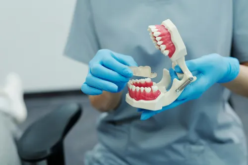 Dental Sealants at Hometown Dental